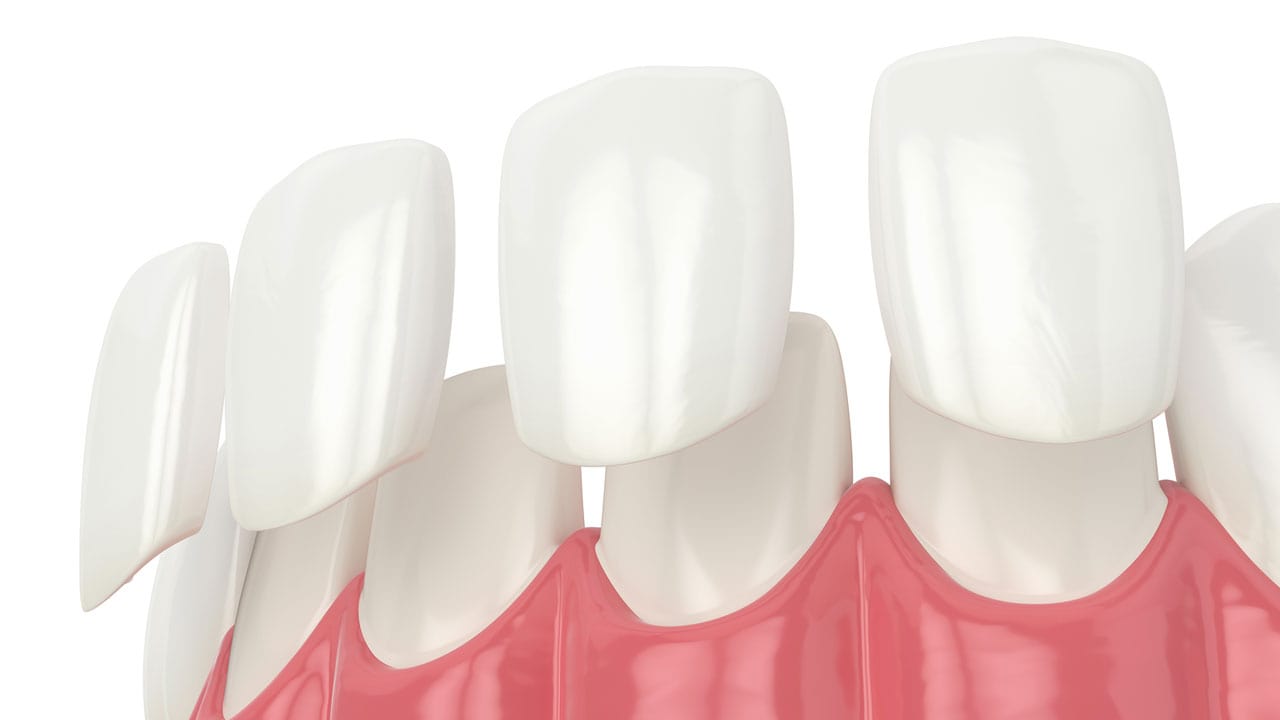 Dentist in Crest Hill